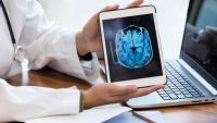 Neurologist discussing MRI scan with a patient
